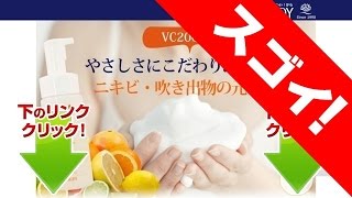 薬用ＶＣ泡フォーマーセットを乾燥肌とニキビに使ってみた