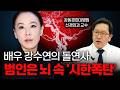 뇌출혈 주범 뇌동맥류, 터지기 전 알아차리는 법 [신희섭 강동경희대병원 신경외과 교수]