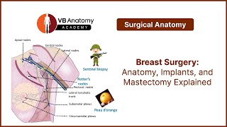 Breast Surgery: Anatomy, Implants, and Mastectomy Explained
