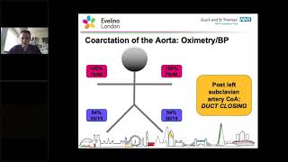 Congenital Cardiac - Dr Bellsham Revell 16Apr2020