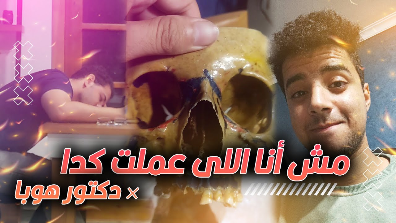 أترفدت من الشغل | عملت مقلب في المدير دكتور هوبا ودي النتيجة