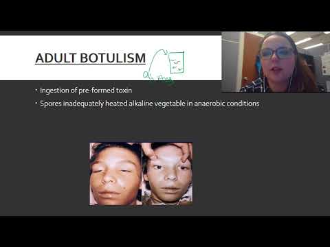 Video: Botulism și Miere: Botulism La Sugari și Adulți