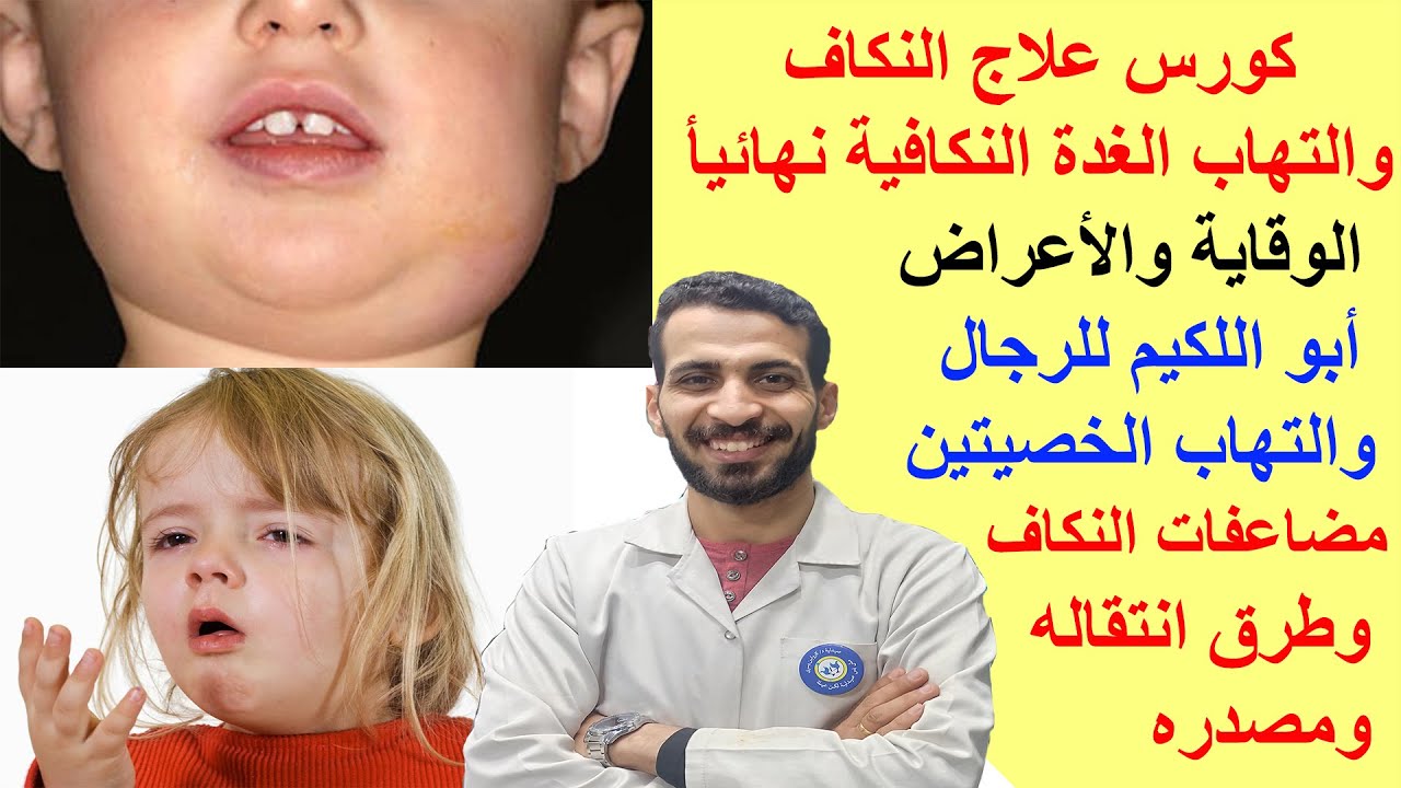 كورس علاج النكاف والتهاب الغدة النكافية نهائيأ _الوقاية والأعراض_ أبو اللكيم للرجال والتهاب الخصيتين