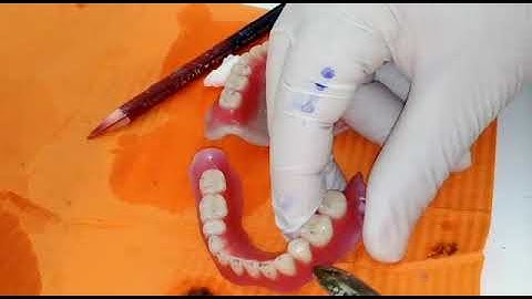 Visit 4: Try-in: checking centric occlusion, which arch to apply adjustments