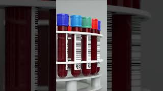 Main Ways HIV is Transmitted