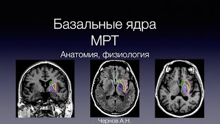 Базальные ядра анатомия (МРТ), физиология. Basal ganglia MRI