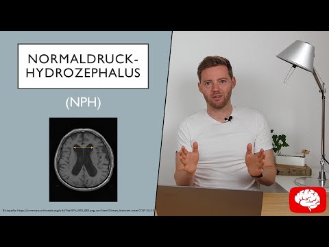 Video: MRT-Untersuchung Der Auswirkungen Von Acetazolamid Und Externer Lumbaldrainage Bei Idiopathischem Normaldruckhydrozephalus