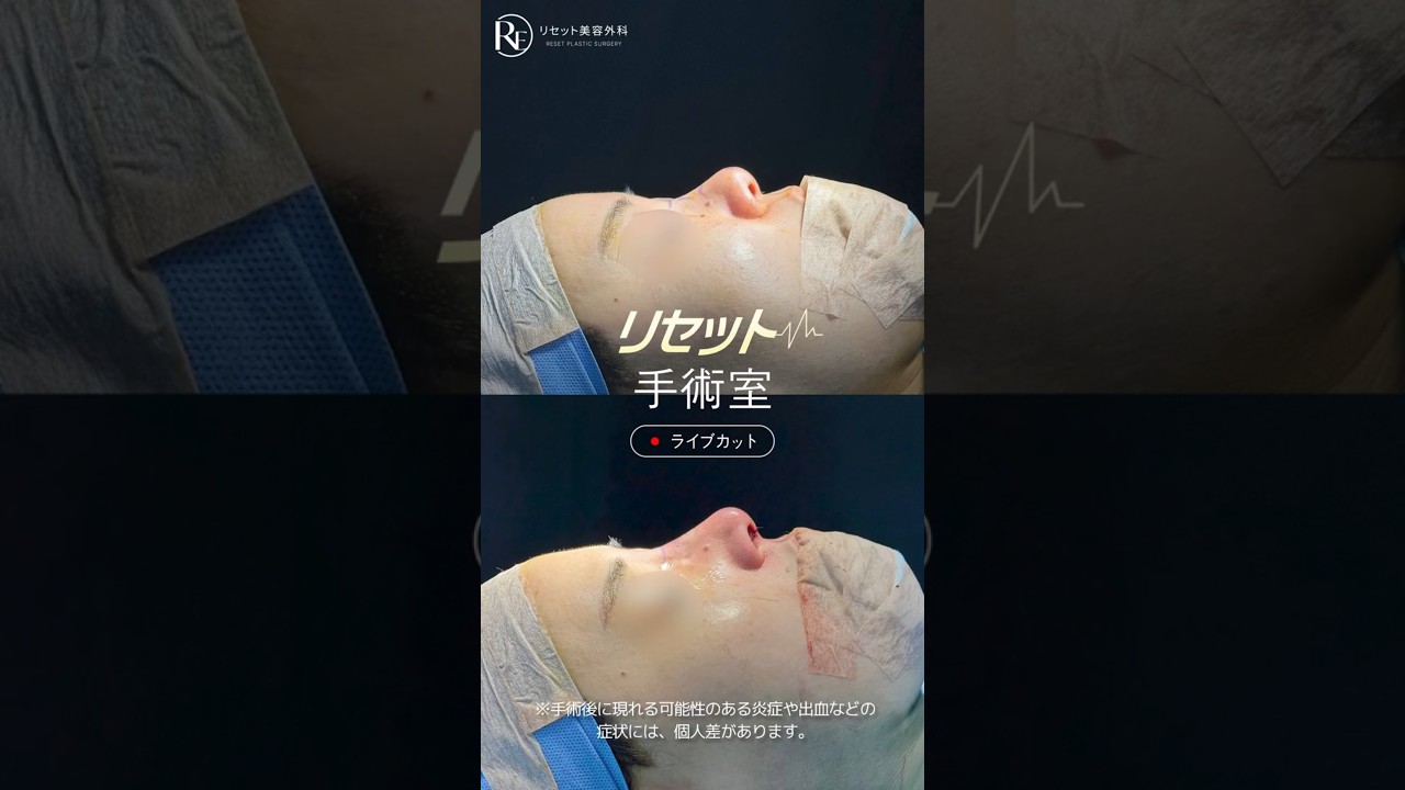 등록한썸네일