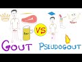 Gout VS Pseudogout