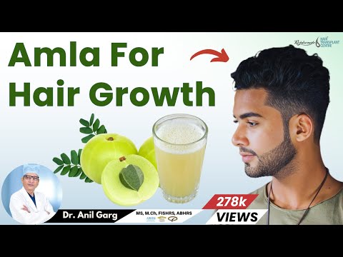 Does Amla Juice Control Hair Loss and Growth | | आंवला रोके बालों का झड़ना | | Dr. Anil Garg