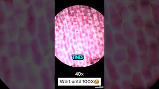 Onion view shock under the Microscope #shortvideo