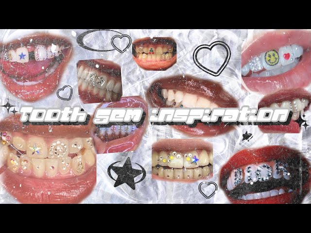 Lesson 4. Tooth gems decoration patterns. Teeth gems kit. Tooth gem  training kit. Teeth gems kit 