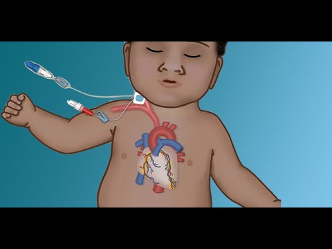 "Parenteral Nutrition: Indications and Practical Applications" by Katelyn Ariagno for OPENPediatrics