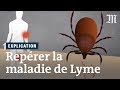 Maladie de Lyme : comment la repérer ?