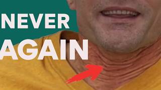 Neck Filler 2 Years On – The Truth About My £600 Neck Wrinkles Fix