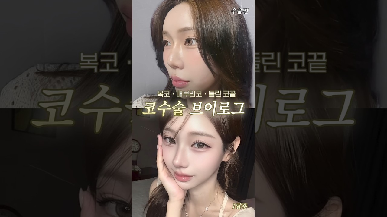 등록한썸네일