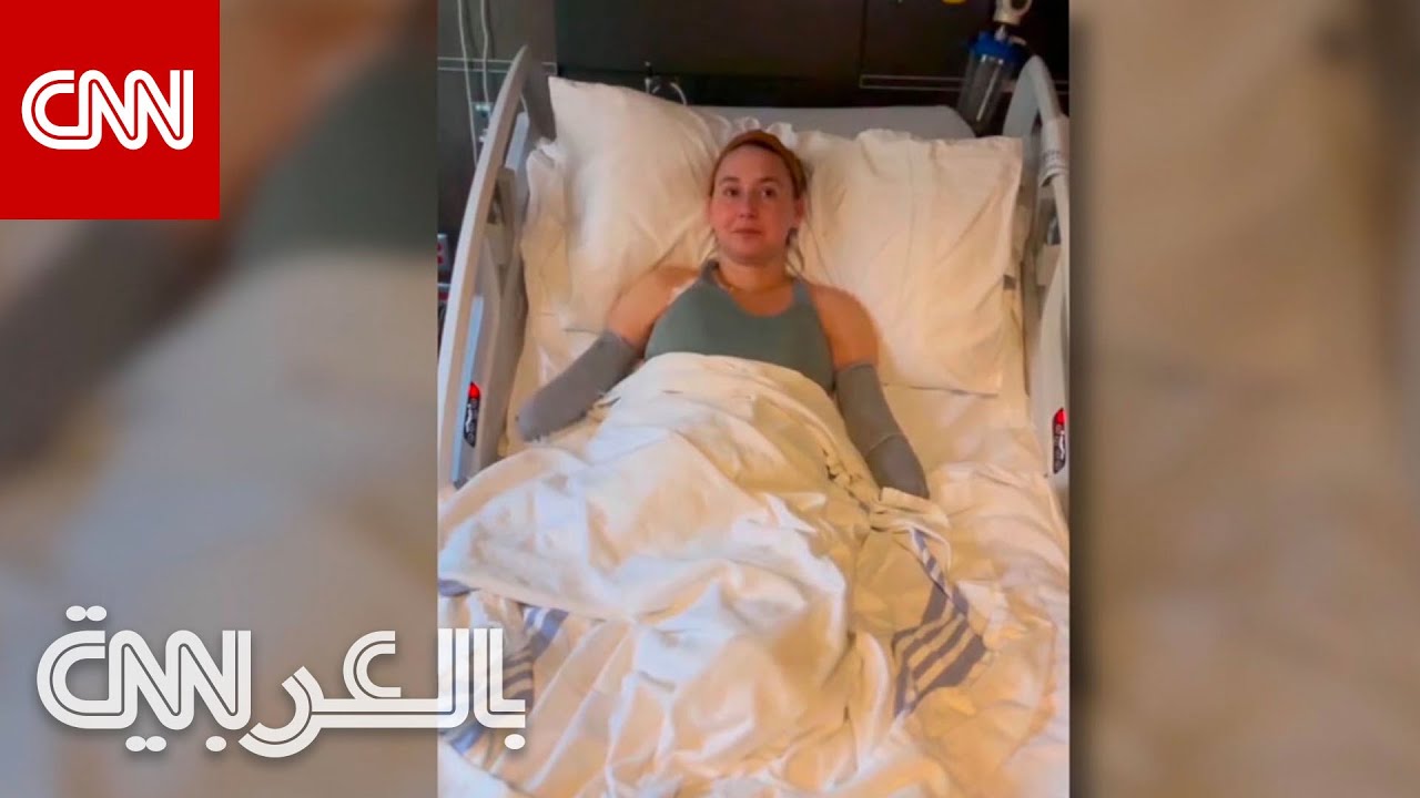 ولادة مبكرة تؤدي إلى عواقب مدمرة.. كيف انتهت رحلة هذه الأم بفقدان ذراعيها وساقيها؟