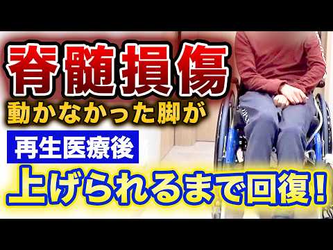『硬膜整体　D２』：わずか５分の完全根本治療 Spinal Cord Injury Regenerative Medicine] The area that was