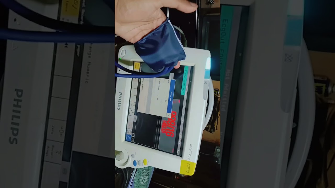 patient monitor calibration 