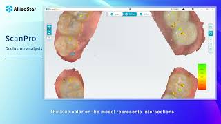 Allied Star - ScanPro Occlusion analysis