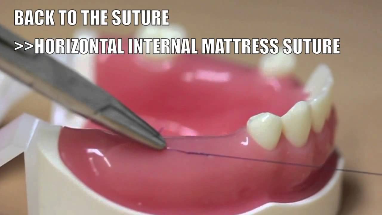 Back to the suture 3 Horizontal internal mattress suture YouTube