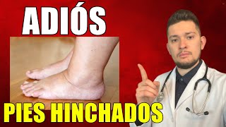 🔴 PIES y TOBILLOS HINCHADOS | Cómo Eliminar los Tobillos Hinchados