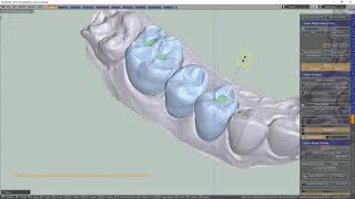 B4D Dental Modules- Crown Module