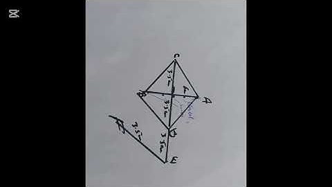 How to mark Limberg Flap,What are lengths of the points, Pilonidal Sinus treatment, plastic surgery 
