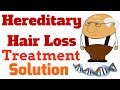 How To Stop Hereditary Hair Loss | Best Baldness Treatment and Solution | Hindi