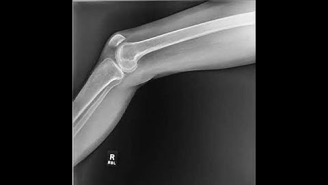 Knee X-Ray in Motion