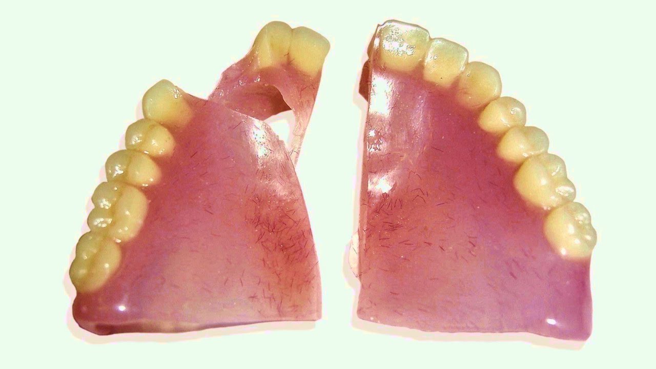 How to Repair a Broken Denture in 25 Minutes - YouTube