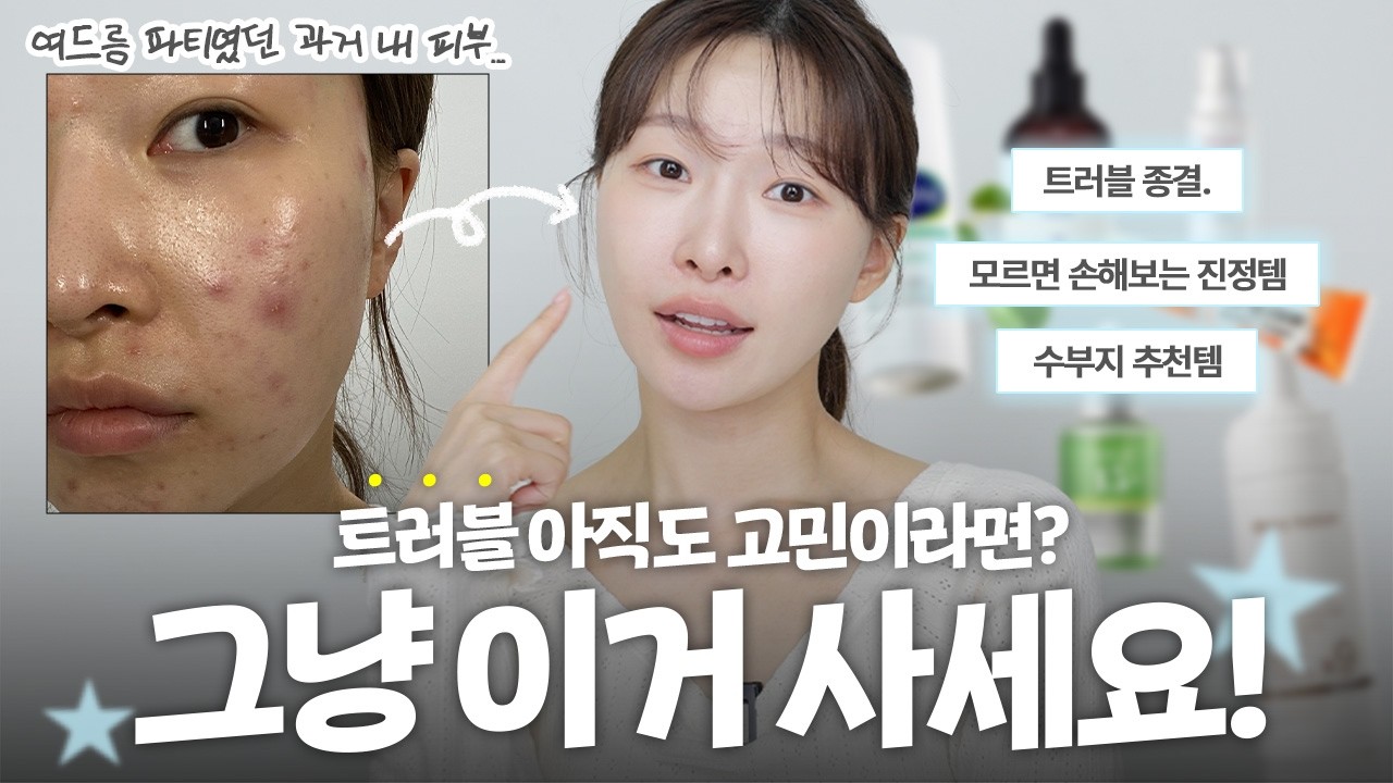돈 낭비 그만 ❌여드름·좁쌀 다 겪고 정착한 인생템 추천 | 아랑
