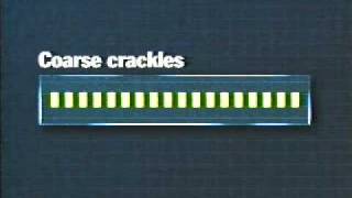 Adventitious Breath Sounds