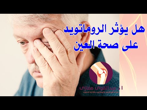 هل يؤثر الروماتويد على صحة العين | أستاذ دكتور عبدالقوى مغازي