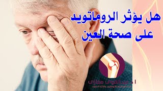 هل يؤثر الروماتويد على صحة العين | أستاذ دكتور عبدالقوى مغازي