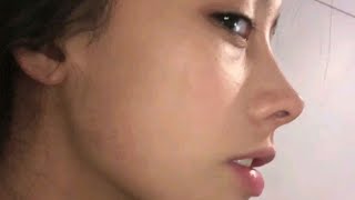 experimental ​nose tip reduction 1X MAX Experimental Nose Tip Reduction