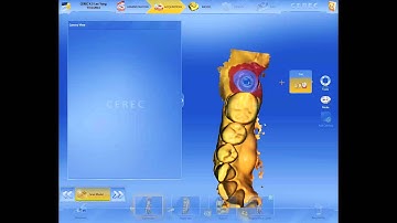 CEREC 4.3 Update - Faster "Cut Tool"