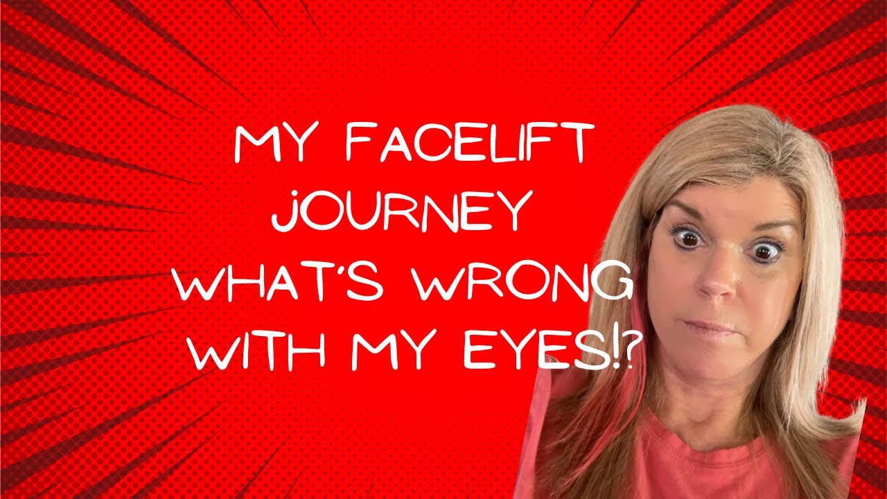 Yes my eyes are closing weird, let’s talk about it! YouTube