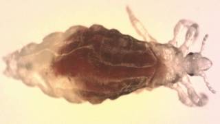 Vamousse Head Lice Solutions Introduction and How Vamousse Works