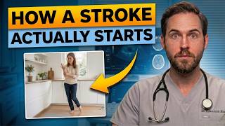What a Stroke Looks Like the Day Before It Hits — Know This to Protect Yourself