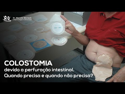 Perfuração intestinal. Precisa de colostomia?