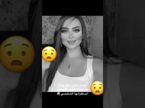 سوسن هارون قبل و بعد