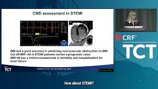 Dr. Toleva on Medis QFR® at TCT 2023 – Microvascular Dysfunction Assessment