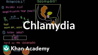 Diagnosis, treatment, and prevention of chlamydia | Infectious diseases | NCLEX-RN | Khan Academy