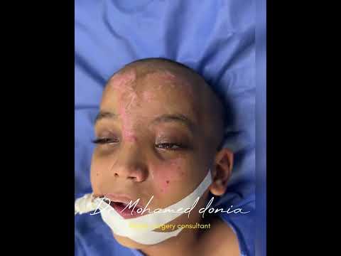 كسور الوجه و الفكين دكتور تجميل كسور الوجه