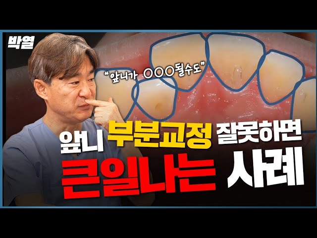 이런 분들이 부분교정하고 낭패봅니다ㅜ