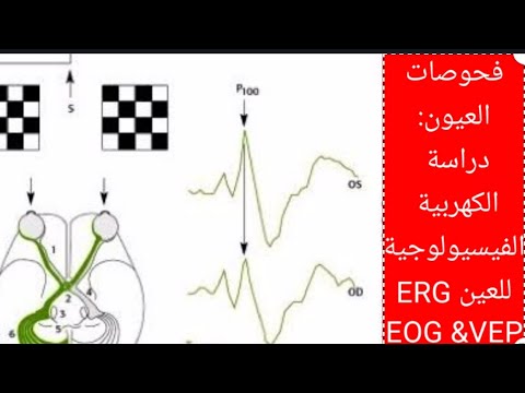 دراسة الكهربية الفسيولوجية للعين   