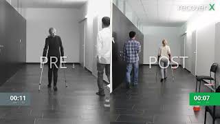 Before/After recoveriX - MS - T25FW walk back - MS5