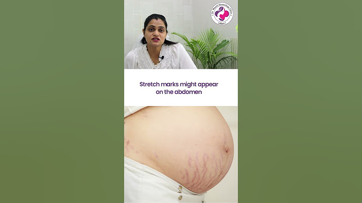 Changes in Mother at 21st Week of Pregnancy - 21वें सप्ताह में माँ के शरीर में होने वाले बदलाव
