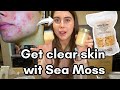How to make Sea Moss for Acne Free Skin and Collagen Production!!!
